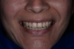 CGH_0193