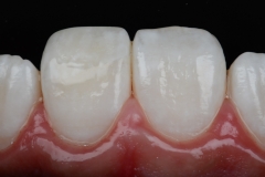 CGH_1767