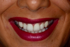 Versión 2