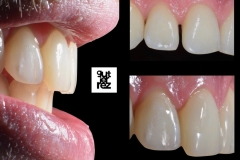 INSTAGRAM-62-CIERRE-DIASTEMA-1.1-1.2-ESTEBAN-VERGARA.001